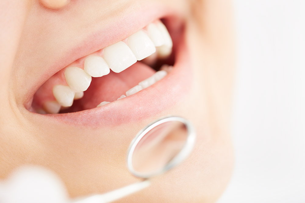sealants in thousand oaks