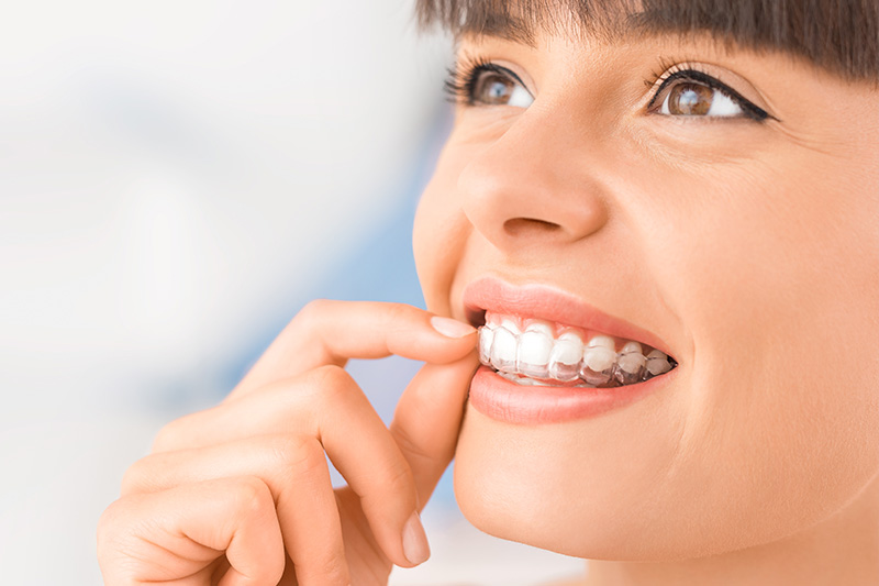 Orthodontics in Thousand Oaks